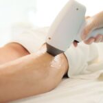 Device for Laser Hair Removal