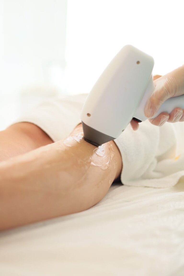 Device for Laser Hair Removal